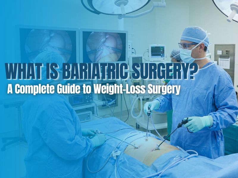 What Is Bariatric Surgery